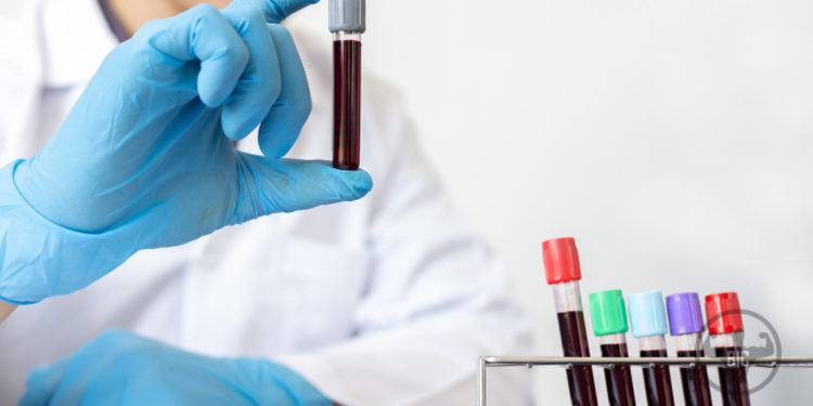 BLOOD-WORK-FOR-PED-USERS