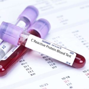 BLOOD WORK FOR STEROID USERS and the C-reactive blood test