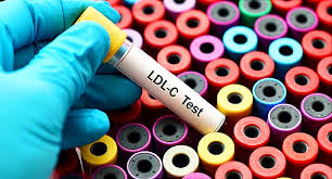 Cholesterol Carriers test