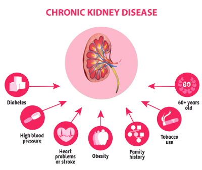 chronic kidney disease photo