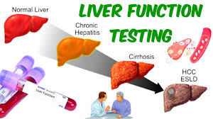 Blood Work For Steroid Users And Why Its Important