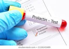 Prolactin blood work test