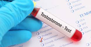 testosterone blood work test